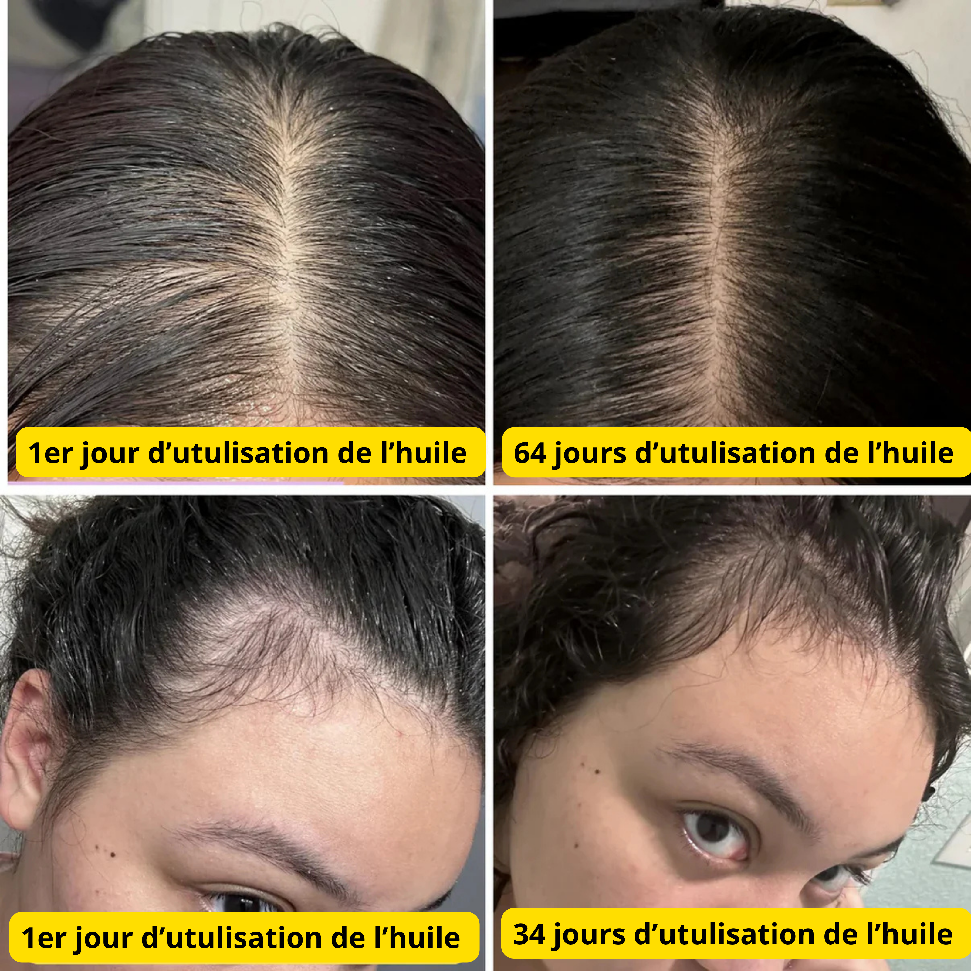 Huile de Croissance Naturelle